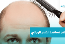 علاج تساقط الشعر الوراثي
