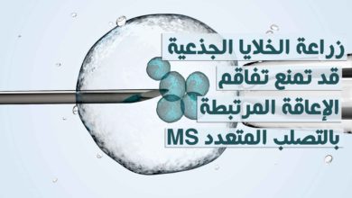 زراعة الخلايا الجذعية قد تمنع تفاقم الإعاقة المرتبطة بالتصلب المتعدد MS