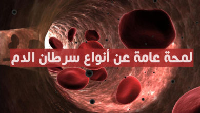 لمحة عن أنواع سرطان الدم