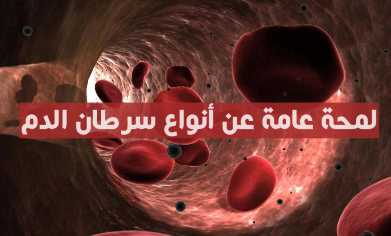 لمحة عن أنواع سرطان الدم