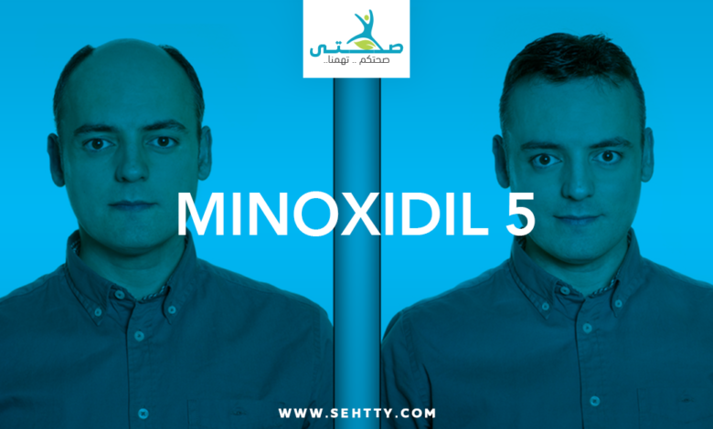 minoxidil 5