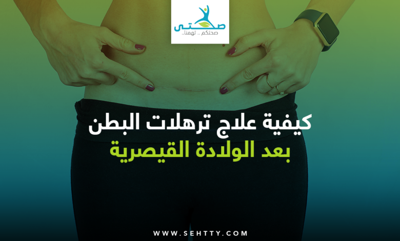 علاج ترهلات البطن بعد الولادة القيصرية