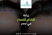 زراعة الشعر للنساء في مصر