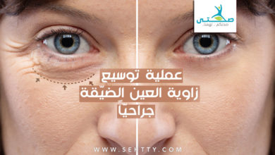 عملية توسيع زاوية العين الضيقة جراحياً